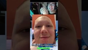 How I got bald on stream #csgo #cs2 #twitch