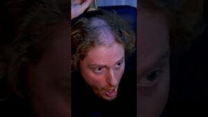 ВМЯТИНА НА ГОЛОВЕ? ☠️ #cs #csgo #donk #cs2 #m0nesy #s1mple #valve